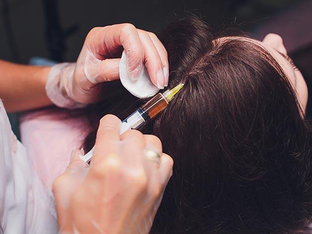 prp hair loss treatmentNJ